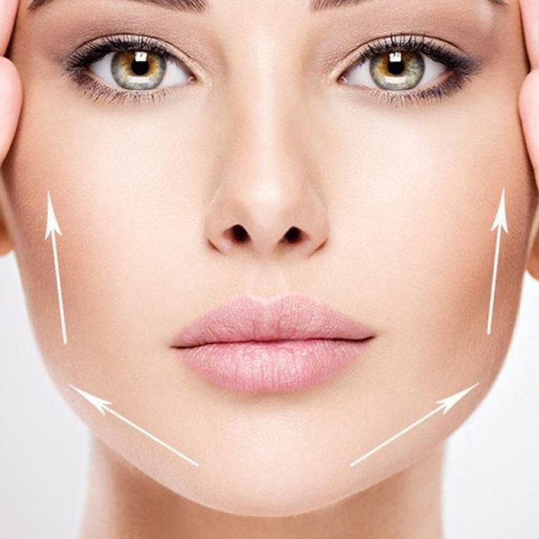 Masseter Botoks