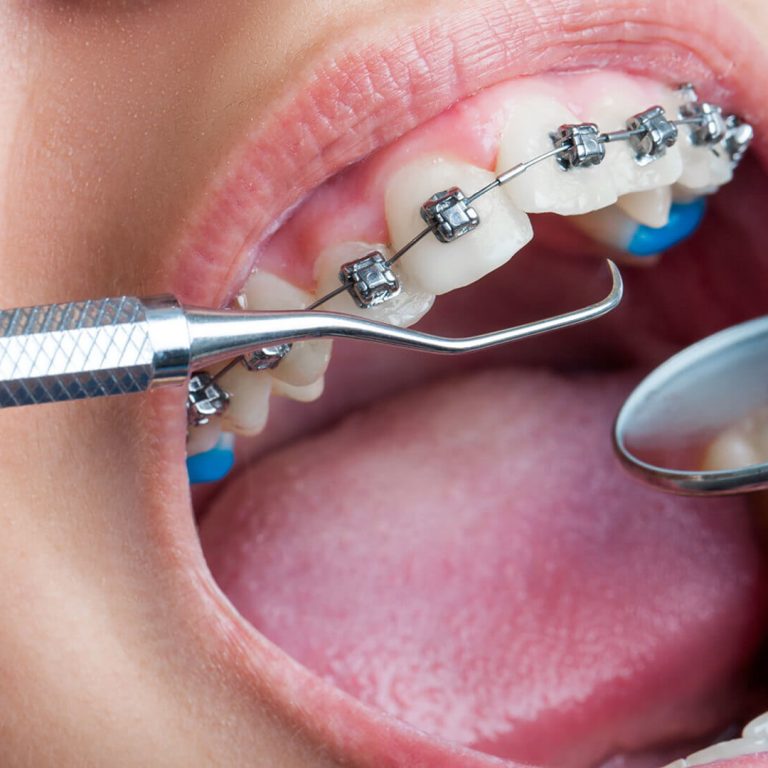 Periodontoloji